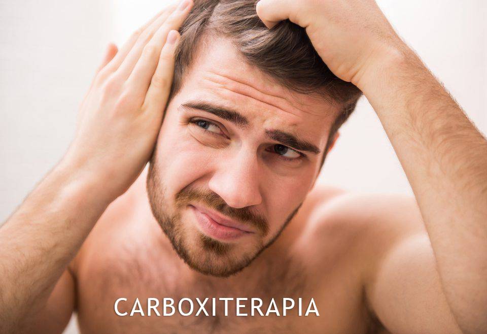 Carboxiterapia, el método para revitalizar el cabello