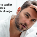 Tratamiento capilar para hombres